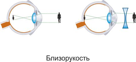 Роли и функции тифлофлешплеера в повседневной жизни людей, страдающих нарушениями зрения