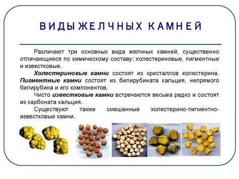 Роль употребления напитков в процессе растворения желчных камней