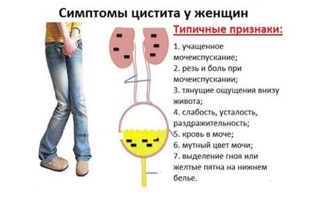 Симптомы, сопровождающие выделение крови при мочеиспускании