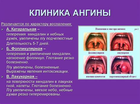 Симптомы и выражения пылкого языка