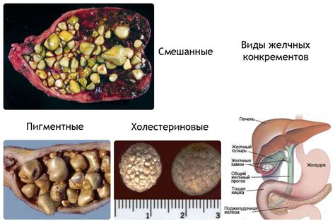 Симптомы и признаки наличия отличительной вещества в органе желчи