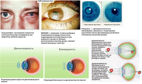 Симптомы и причины отечных глаз