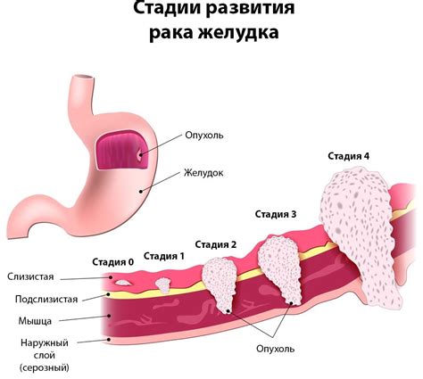 Симптомы неисправности желудка