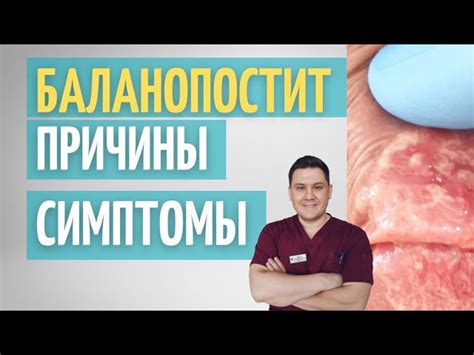 Симптомы неспецифического баланопостита