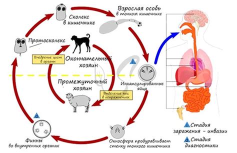 Симптомы поражения эхинококком и их проявление у человека