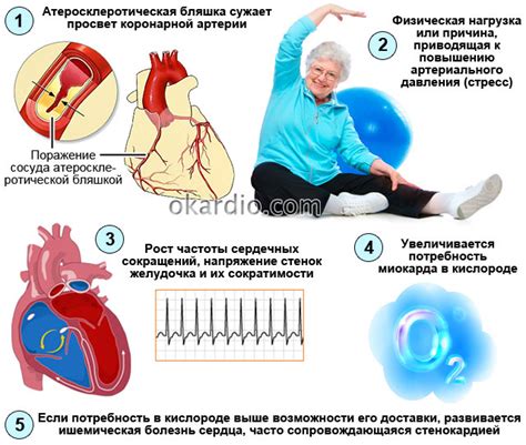 Сны о кипятке как проявление внутренних коллизий и напряжения