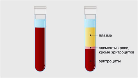 Современные подходы и рекомендации по снижению скорости оседания эритроцитов по методу Вестергрена