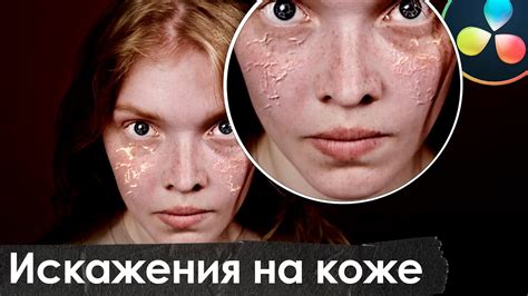 Создание отверстий на поверхности кожи