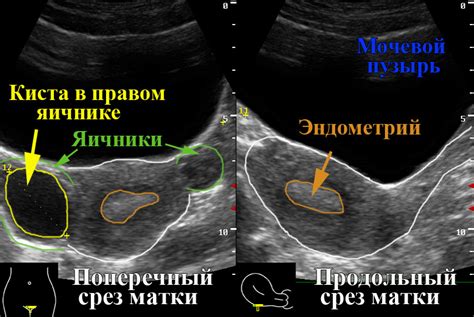 Состав ультразвукового исследования малого таза