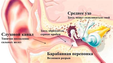 Состояние и последствия забитости ушной канал после применения капель