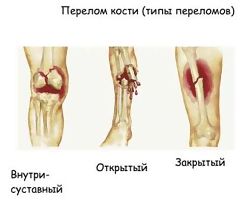 Травма и повреждение