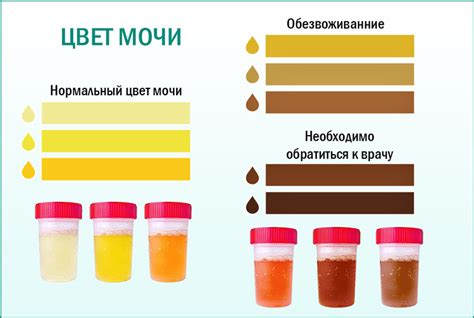 Факторы, приводящие к изменению цвета мочи у представителей мужского пола