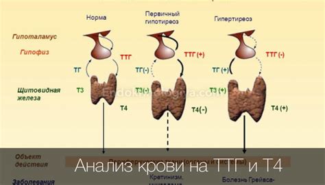 Факторы и важность низких уровней ТТГ и Т4