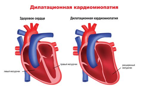 Факторы риска нерегулярного ритма сердца