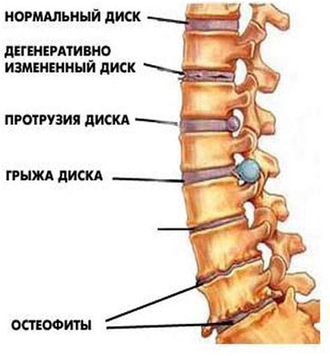 Хирургические процедуры для изменения анатомии позвоночника у мужчин