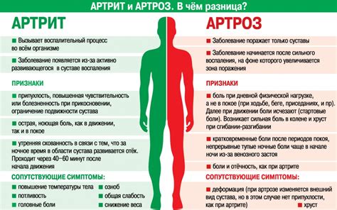 Что такое артрит и артроз?