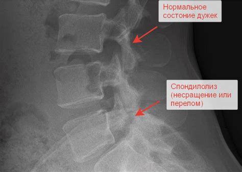 Что такое нестабильность сегментов C2-C6 и как она проявляется?