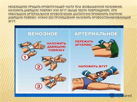  Значимость первичная помощь при повреждении нижней конечности 