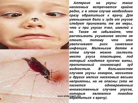  Когда необходимо обратиться к врачу после укуса комара?
