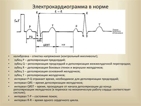  Понятие возможных отклонений ЭКГ у детей 