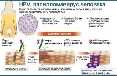  Пути передачи ВПЧ и основные группы риска 